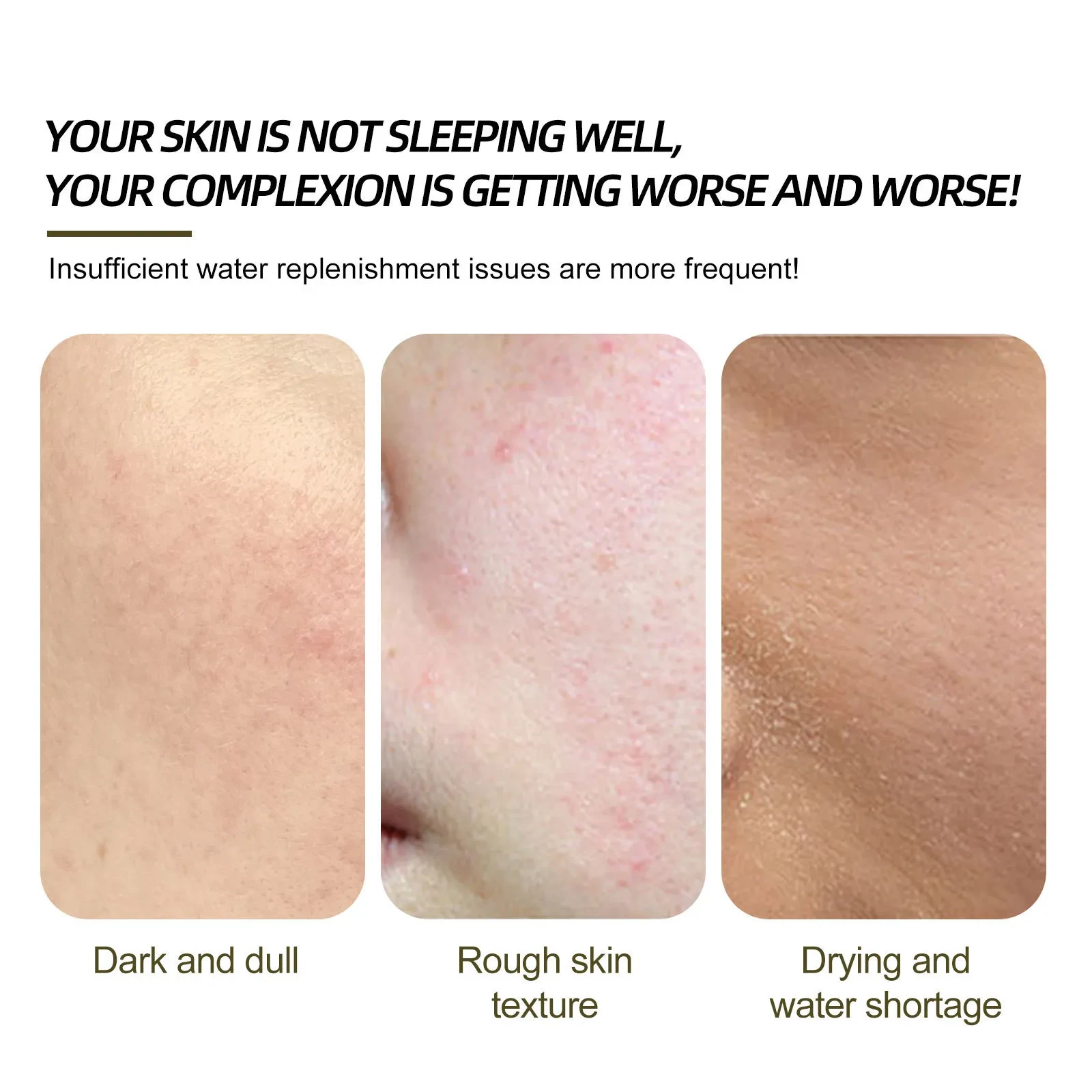 Soothes Skin Dry Smallpox Diluting Moisturizing Liquid