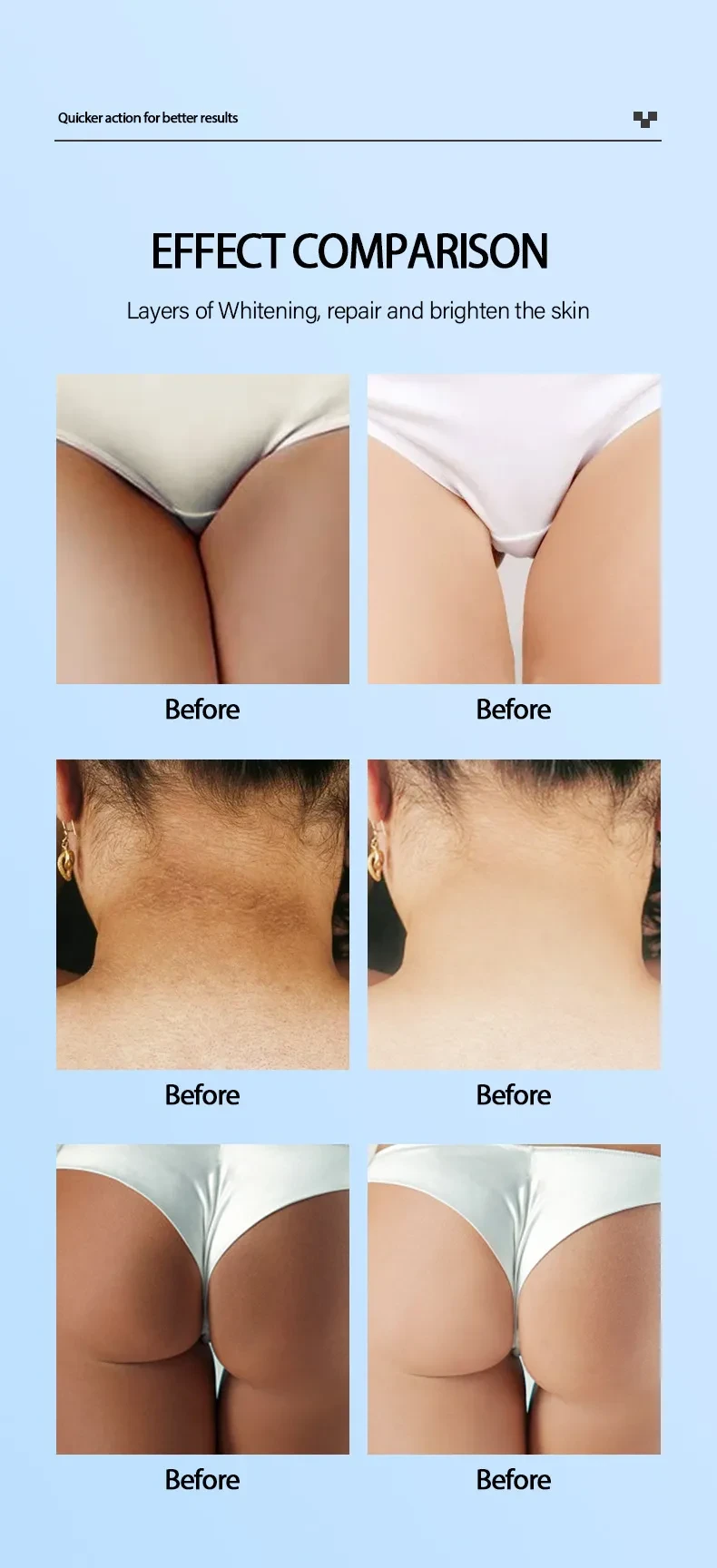 Snow White Blackening Cream Brightening White Skin Rejuvenation