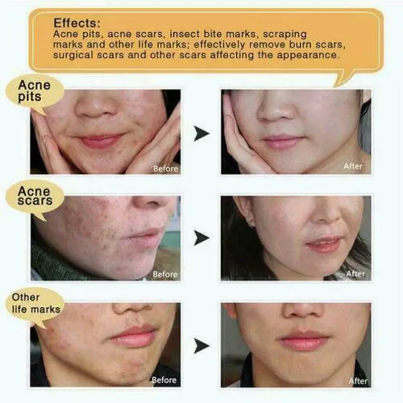 Original Snake Skin care lotion Hand Cream