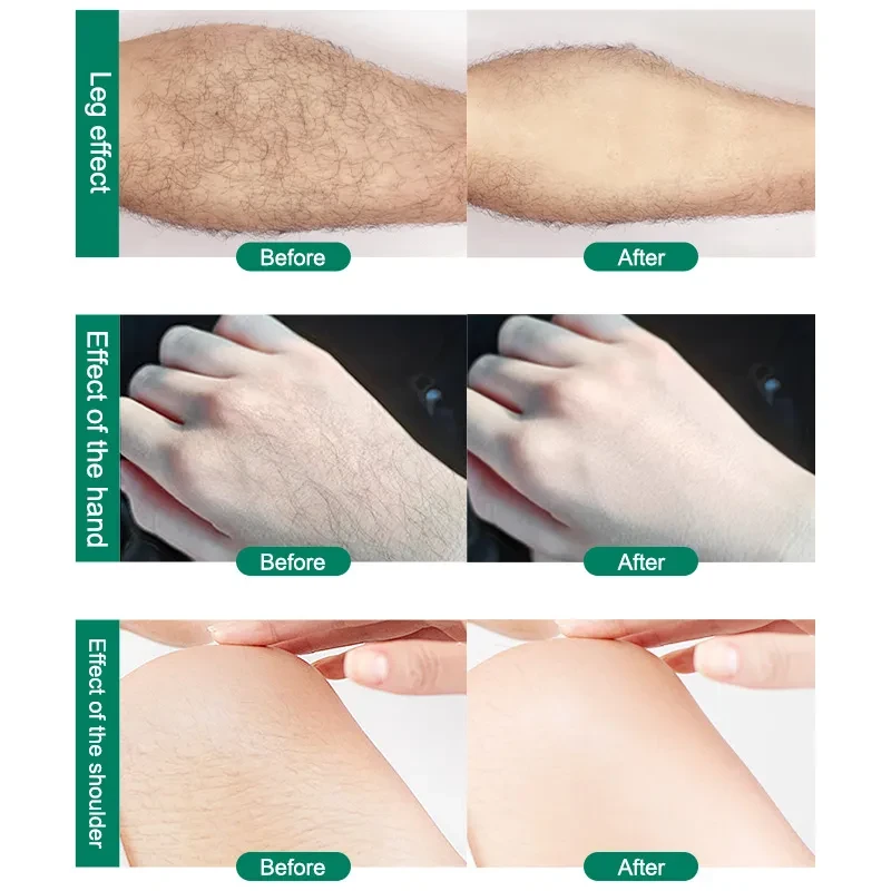 Crystal Hair Removal