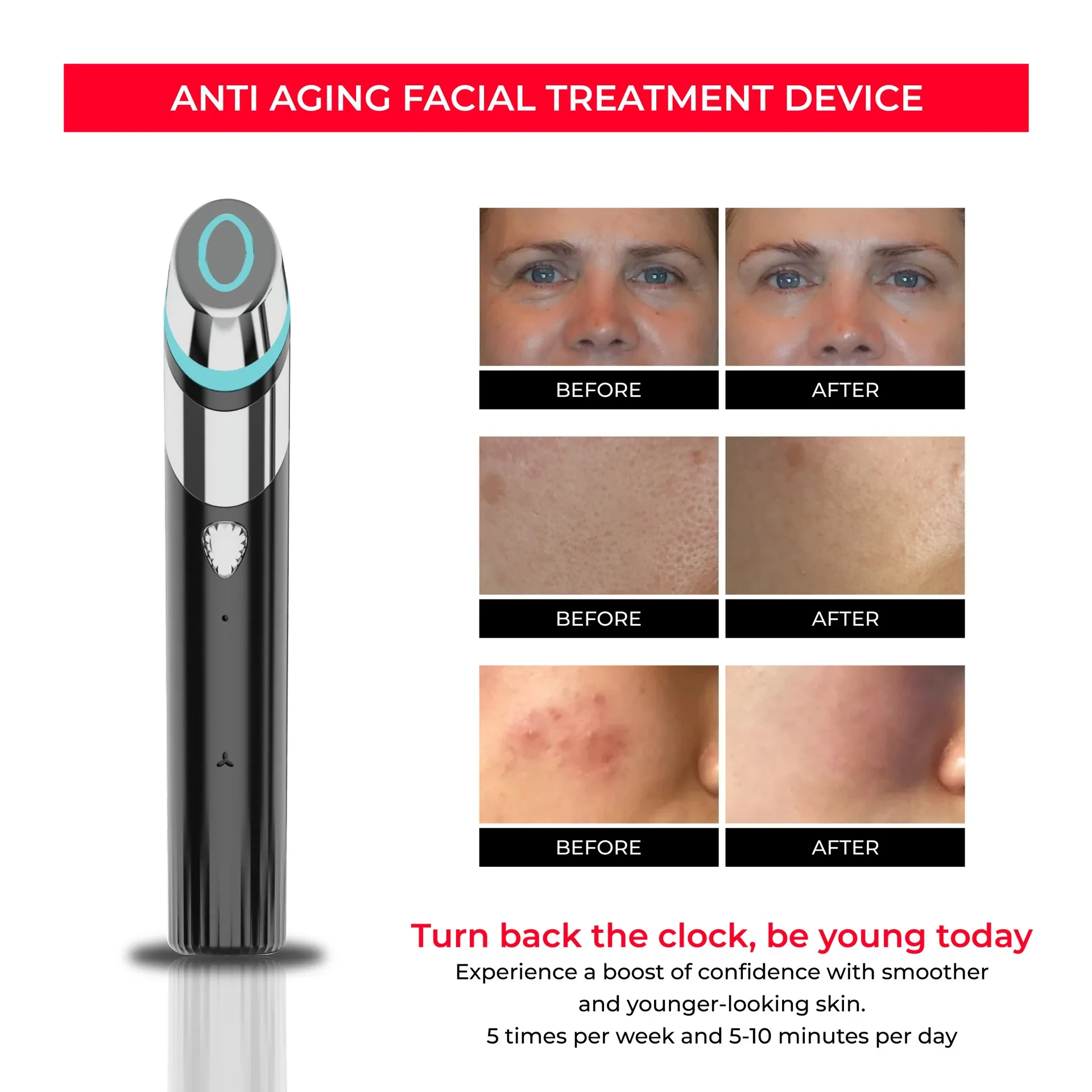 EMS Skin Rejuvenation Device with Microcurrent for Pore Tightening and Skin Firming