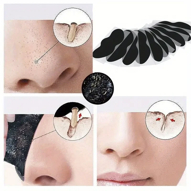 10pcs Activated Charcoal Nose Strips - Deep Cleansing & Blackhead Removal