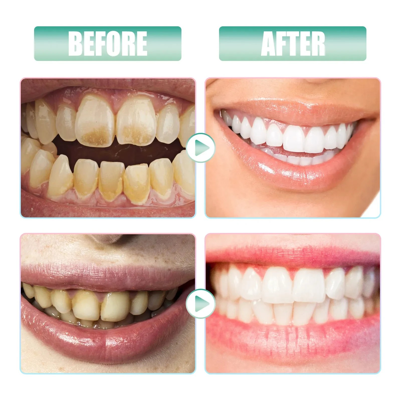 Nicotinamide Toothpaste Whitening Cleaning Care