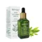 Acne Treatment Serum Facial Repair Oil