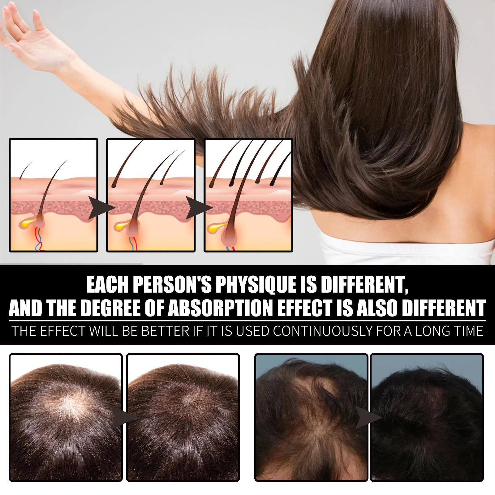 Liquid Biotin & Collagen Hair Growth Drops - Biotin And Liquid Collagen Supplement For Men & Women - Glowing Skin Support, Healthy Hair & Nail Growth