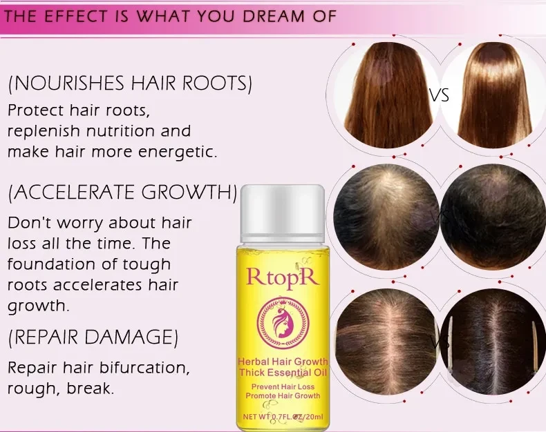 Fast Powerful Hair Growth