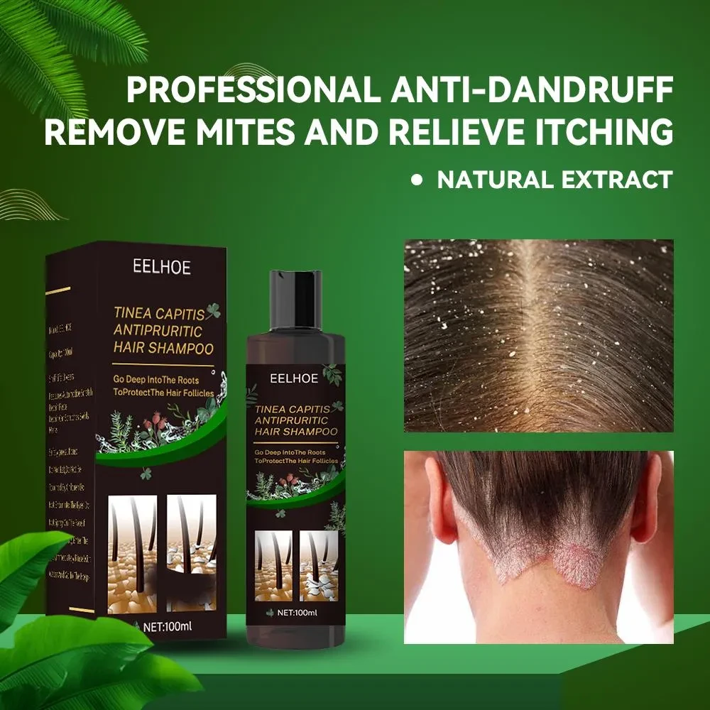 Itch Relief, Hair Loss Prevention, Oil Control & Refreshing Car