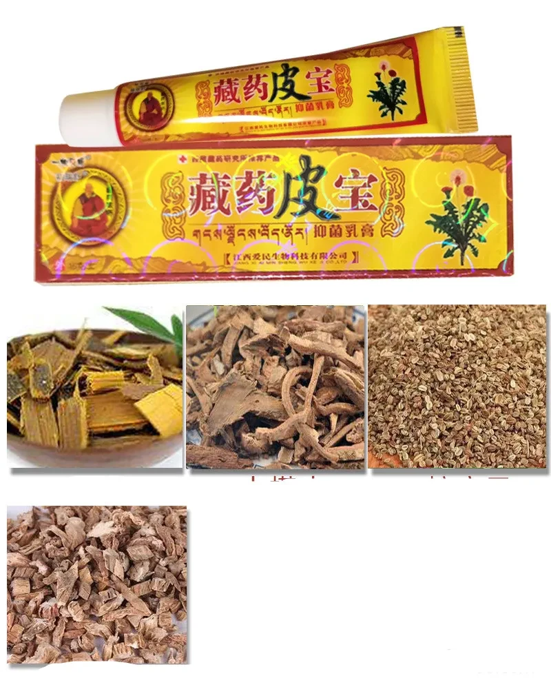 Itchy Skin Care lotion