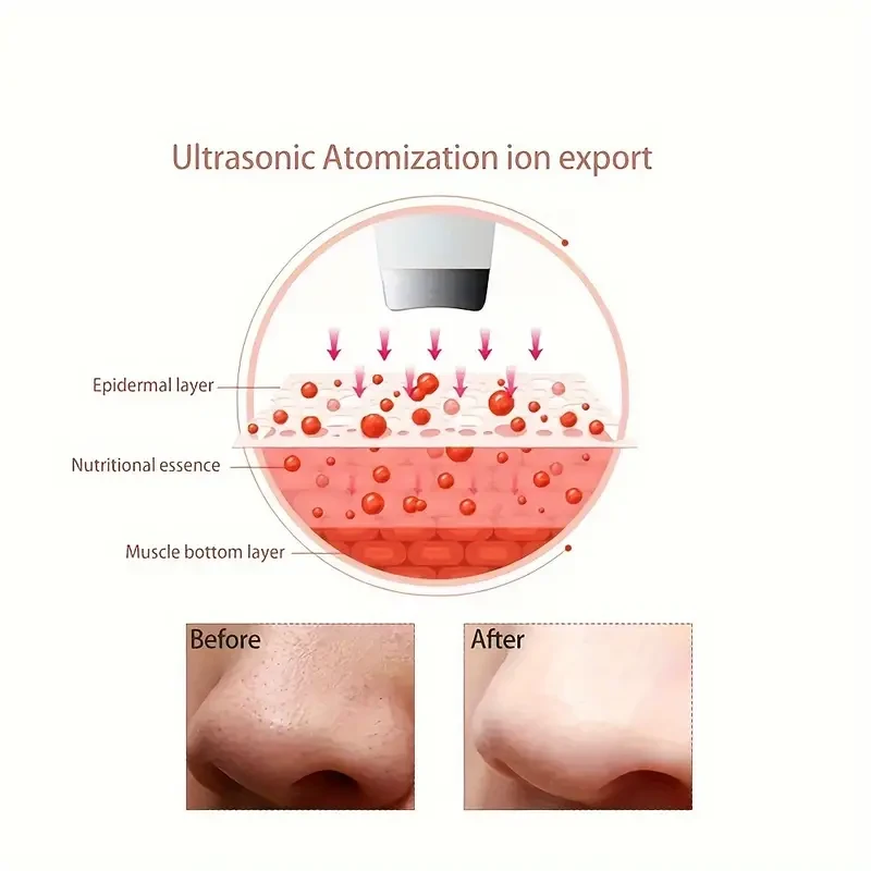 USB Rechargeable Soundwave technology Facial Cleansing Device - Portable Blackhead & Pore Cleaner, Skin Care Tool