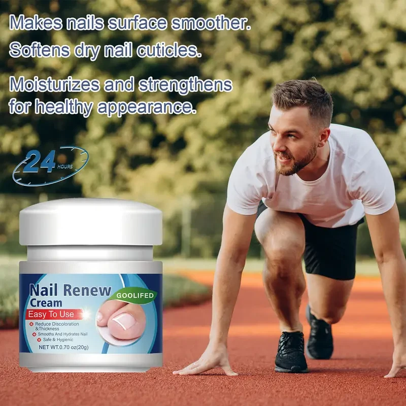 20g Nail Renewal Cream - Strengthens & Thickens Discolored, Yellowed Nails with Glycerin & Lactic Acid for Healthy Growth