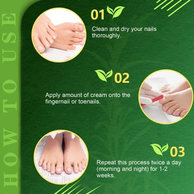 Fenland Nail Renewal Cream 0.70oz - Fast-Acting Treatment for Discolored & Damaged Nails, Formaldehyde-Free, Strengthens & Improves Nail Condition, Nail Care Cream for Men & Women