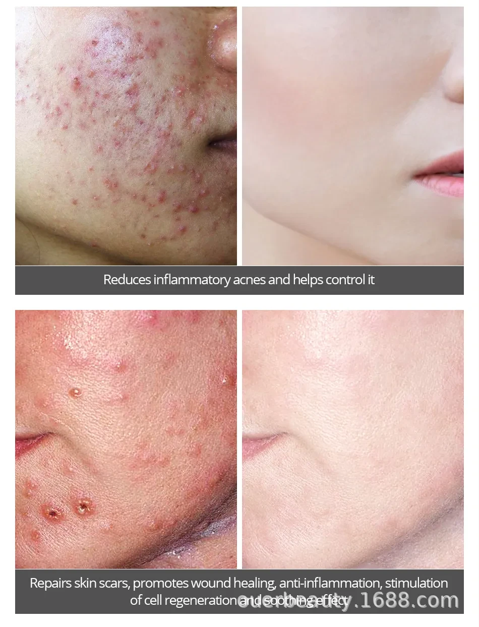 Snail repair care set For Face