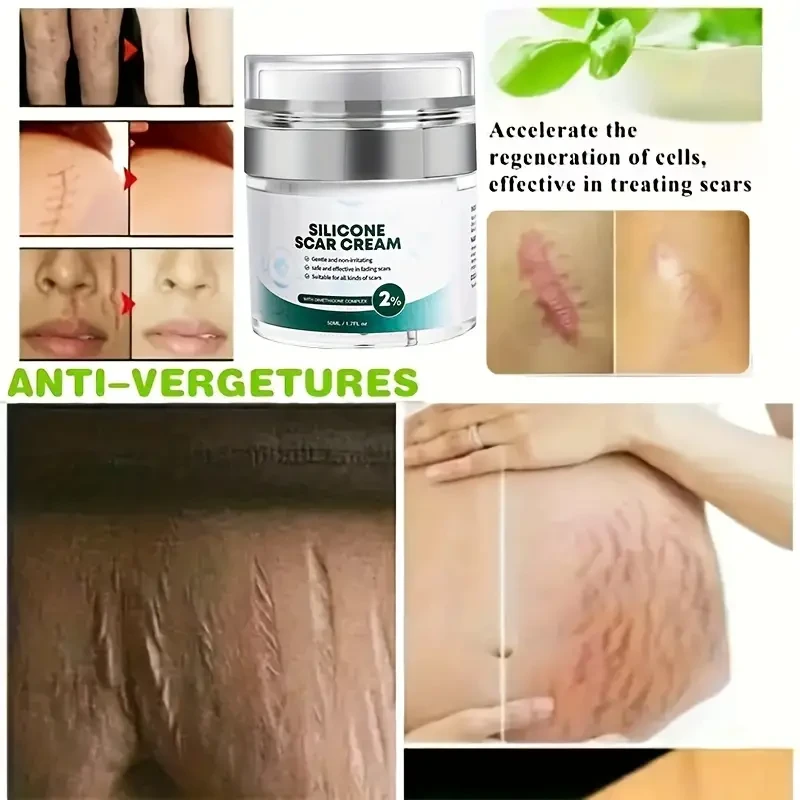 Scar Gel: Advanced Formula For Fading Scars, Acne Scars, Stretch Marks, And Surgical Scars - Skin Repair Treatment Containing Allantoin, Vitamin E, And Silicone Gel - Non-greasy And Quickly Absorbed.