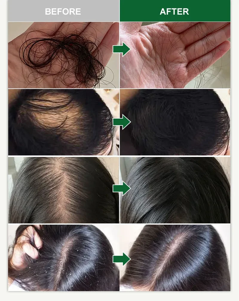 Rosemary Ginger Scalp Smear Care