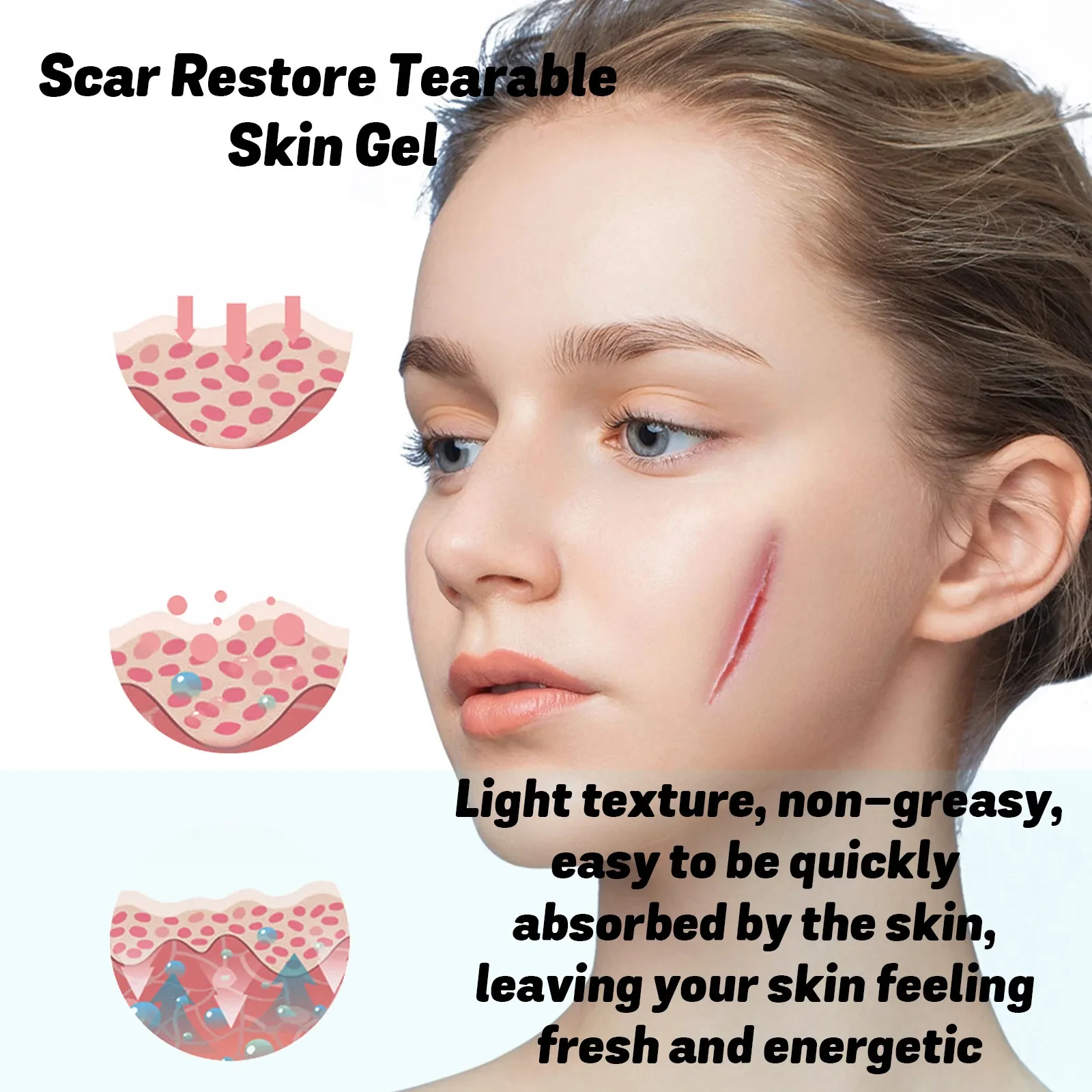 Skin Thinning Care Gel For Scar