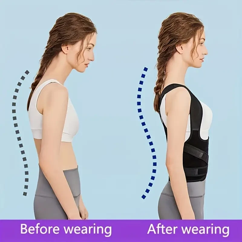 Adjustable Unisex Posture Corrector - Spinal Support for Alignment, Kyphosis & Scoliosis