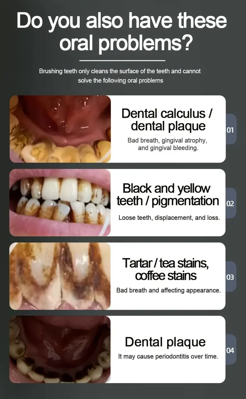 Electric Dental Cleaning Kit with 2 Interchangeable Soft Brush Heads