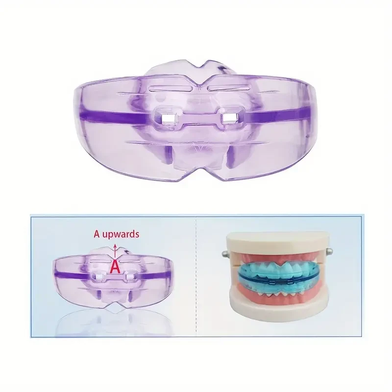 3-Stage Invisible Aligner Kit