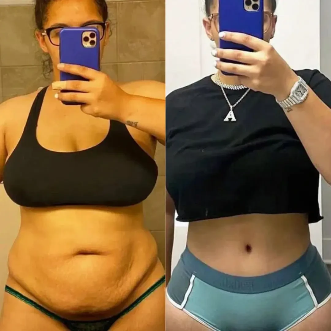 Sonicfit Ultrasonic Cavitation