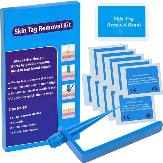 Skin Tag Removal Device, Meat Mole Removal, Corn Removal