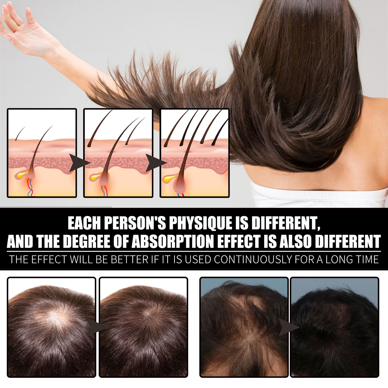 Biotin Fast Oil Hair Regrowth Serum - Anti-Hair Loss Treatment for Hair Thinning