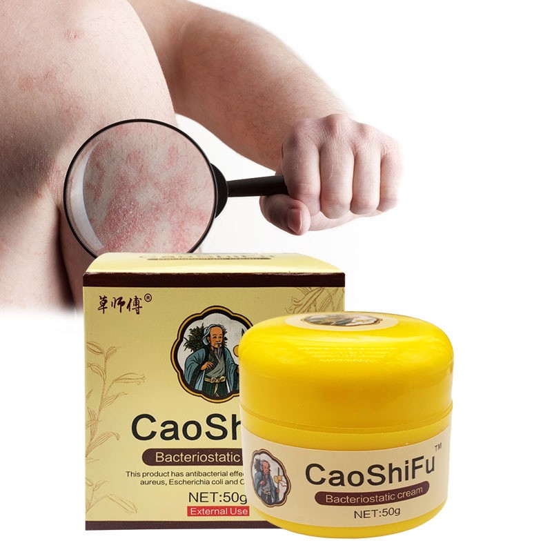 Caoshifu Psoriasis Cream - 4pcs 50g Herbal Skin Ointment