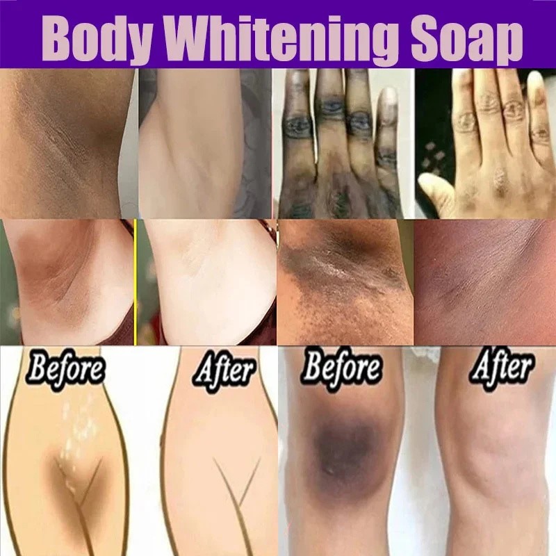 Body Whitening Soap - Deep Clean Skin and Chicken Skin Removal
