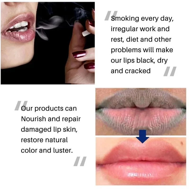 Remove Dark Lip Balm - Lightening & Moisturizing Korean Lip Care