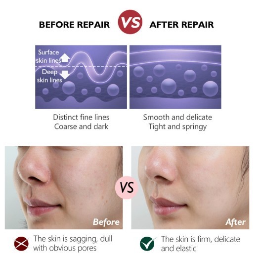 Retinol Tightening Plastic Activating Cream