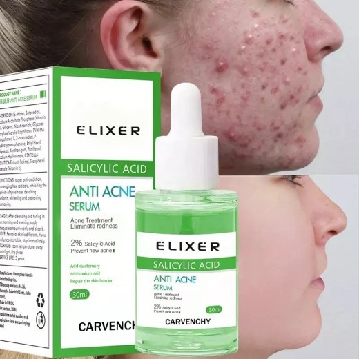 Anti-acne Soothing And Hydrating Skin Moisturizing Lotion Firming