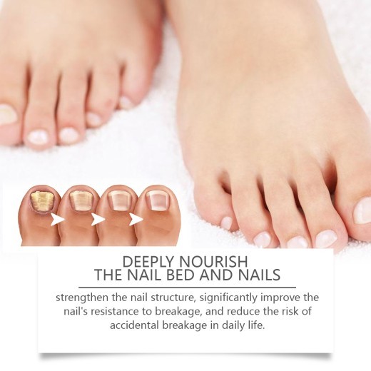 Deep Cleansing Mild Moisturizing And Nourishing Nail Care Solution For Hand