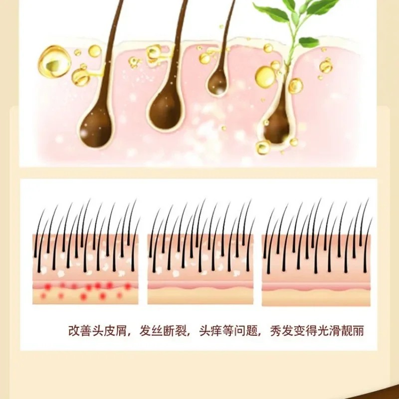 Sulfur Shampoo for Lice, Mites, Dandruff, and Itching  Oil Control, Deep Cleaning, Damage Repair