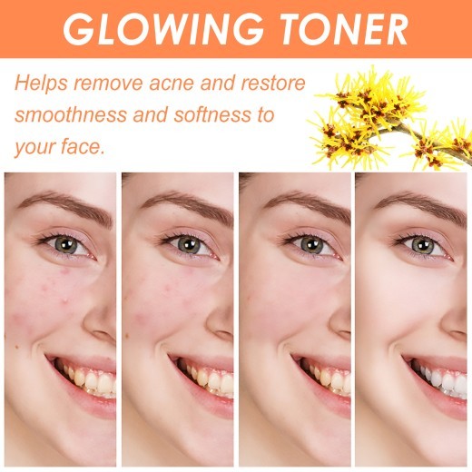 Salicylate Desalting Pimple Acne Marks Gentle And Clean