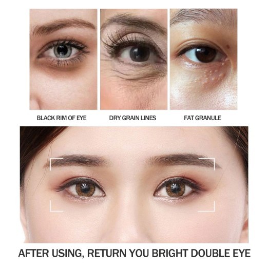 Remove Fat Particles Moisturizing Eye Cream