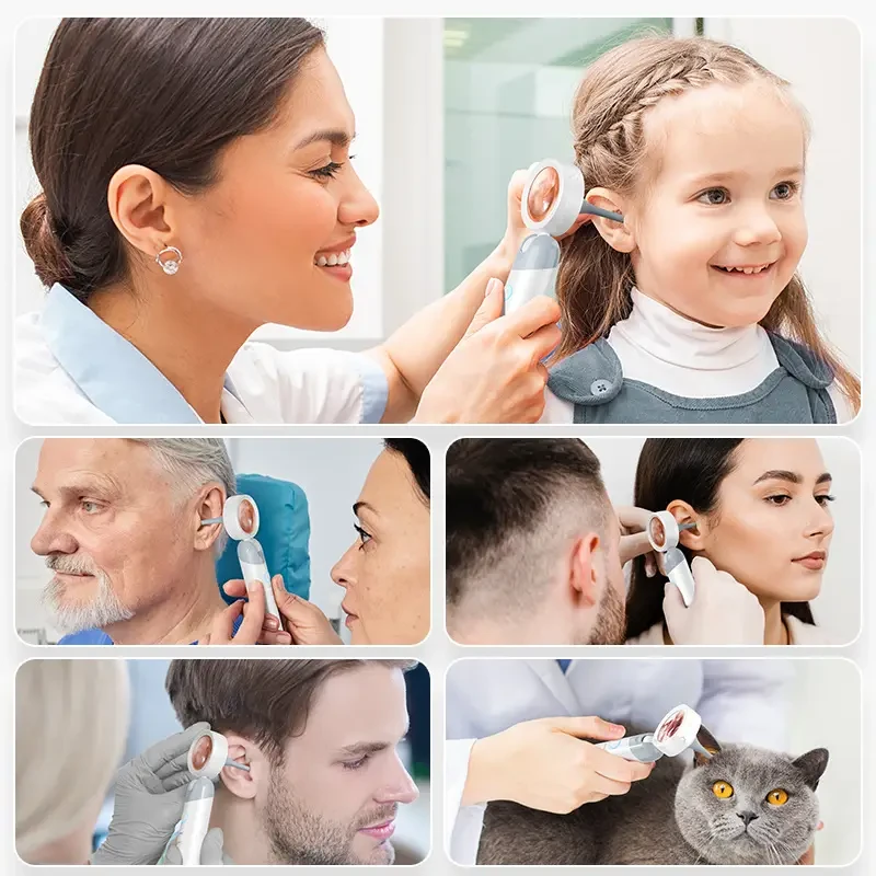 Inskam 4-in-1 Smart Ear & Nose Camera with Screen