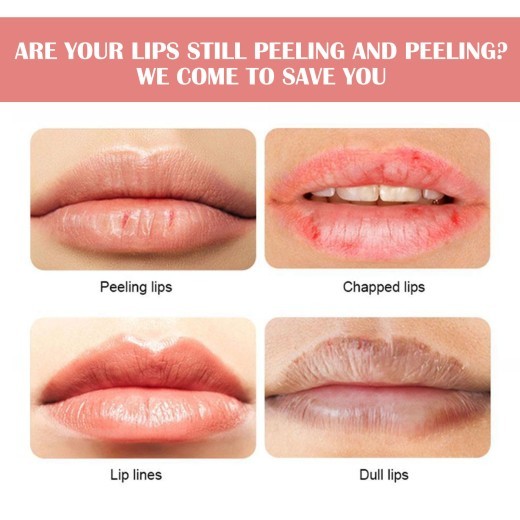 Watermelon Flavor Lip Balm Hydrating Freeze-dried Cracking