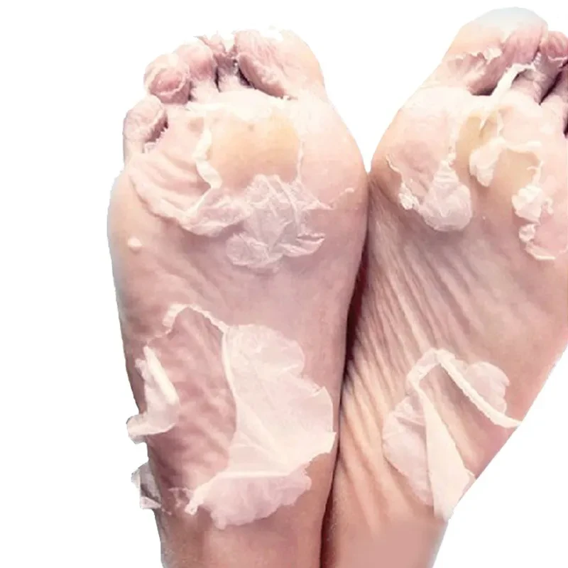 Large Dead Skin Calluses Foot Mask