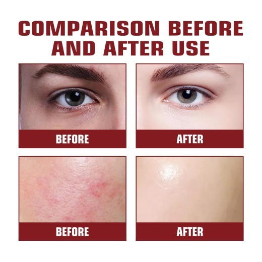 Tender Pores Moisturizing And Softening Cutin Skin Fading Spots Moisturizing Toner