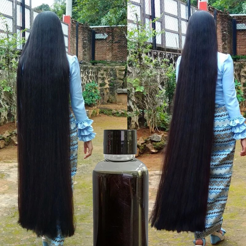 Chinese Herbal Hair Care Hair Growth Product