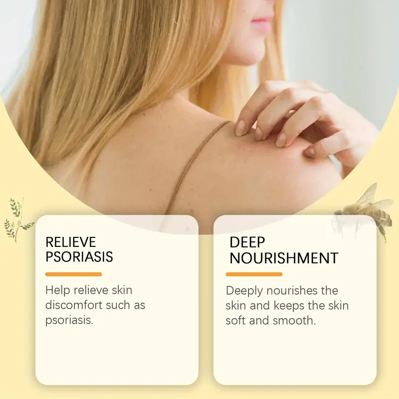 Bee Venom Eczema Care Cream - Soothing & Moisturizing Relief for All Skin Types