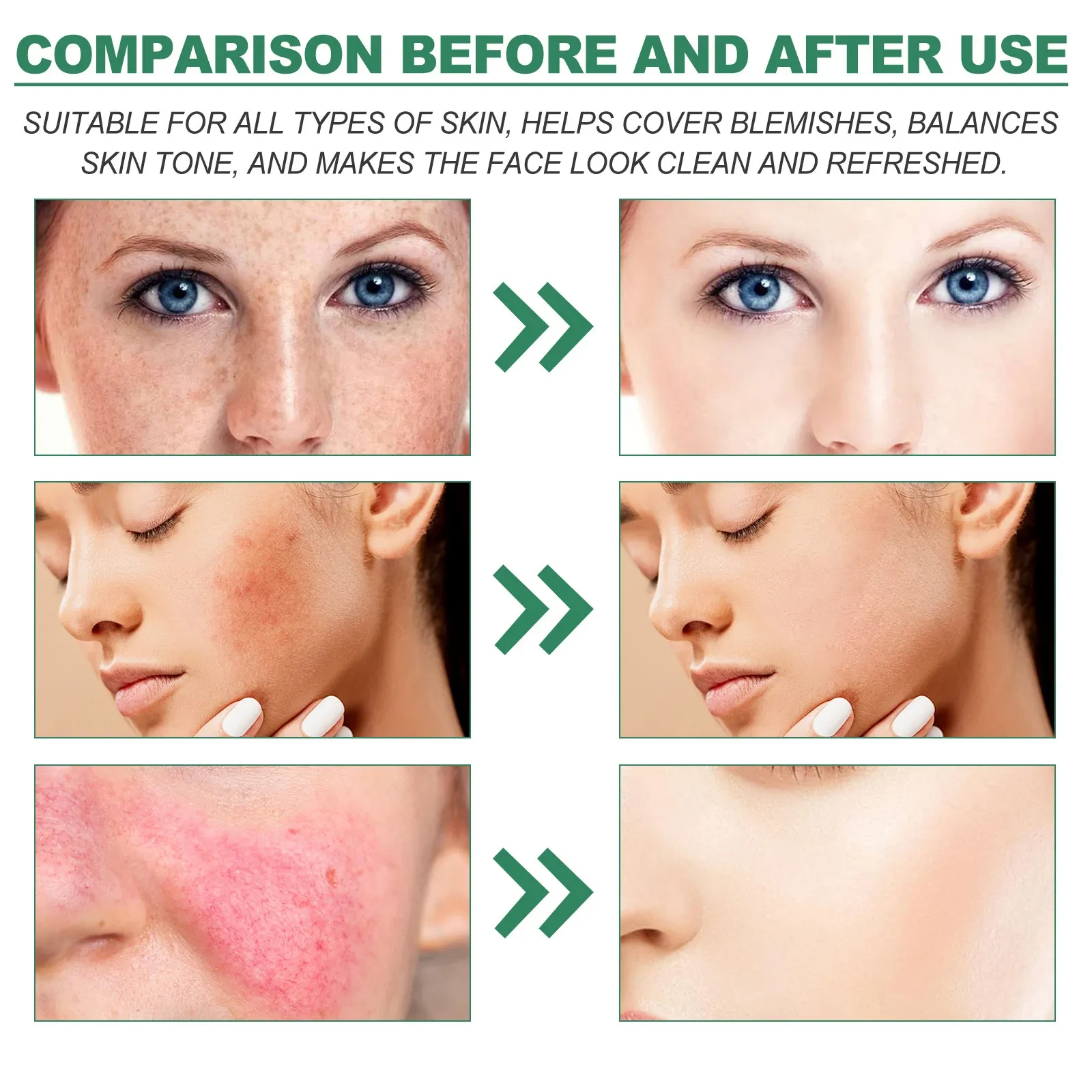 Color Correction Nursing Fade Spots Sun Damage Repair Dark Hydrating Skin Cream
