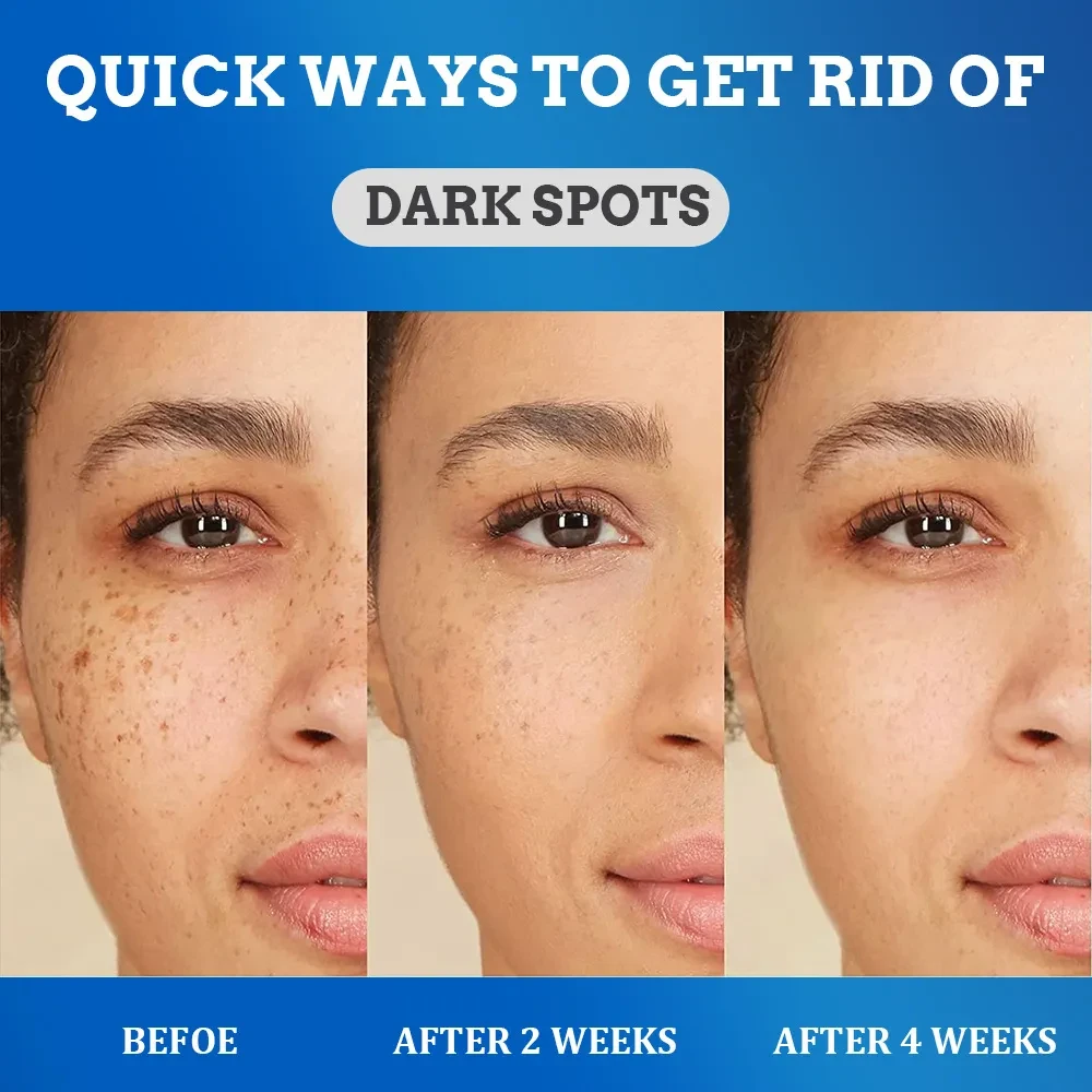 Fade Spot Cream Brightening White Moisturizing Cream