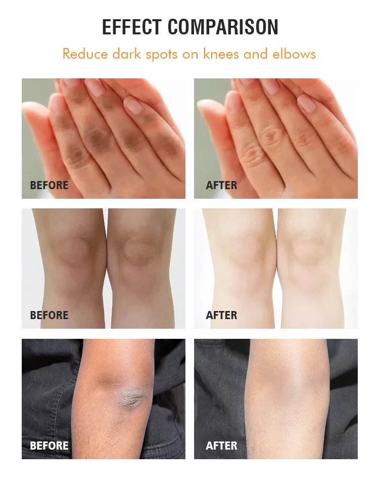 Joint Blackening Cleaning Cream Elbow Knee Ankle Massage Cream