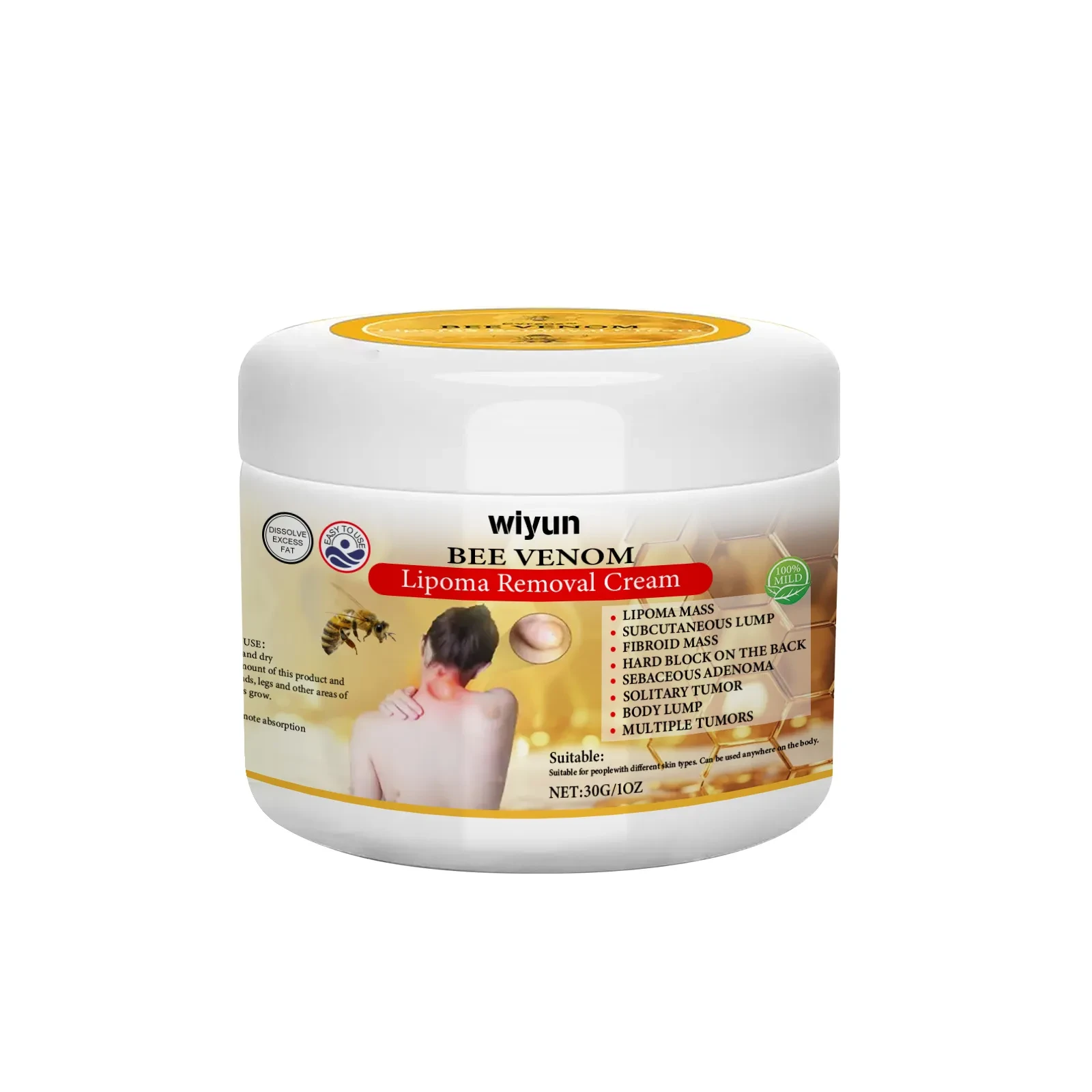 Lipoma Removal Cream